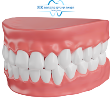 שיניים תותבות 1 360x320